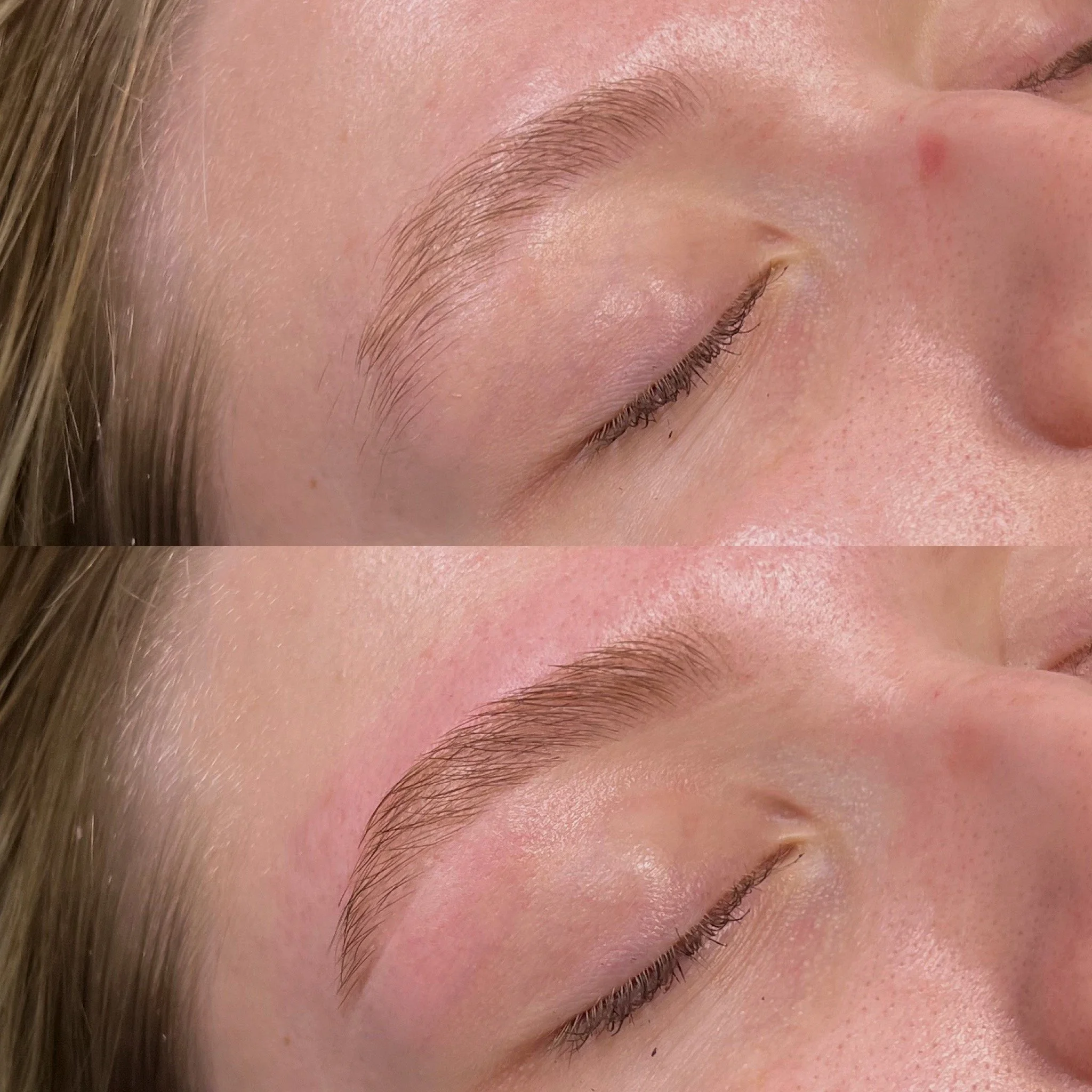 Close-up of a person's face showing the eyebrow, eye, and surrounding skin.