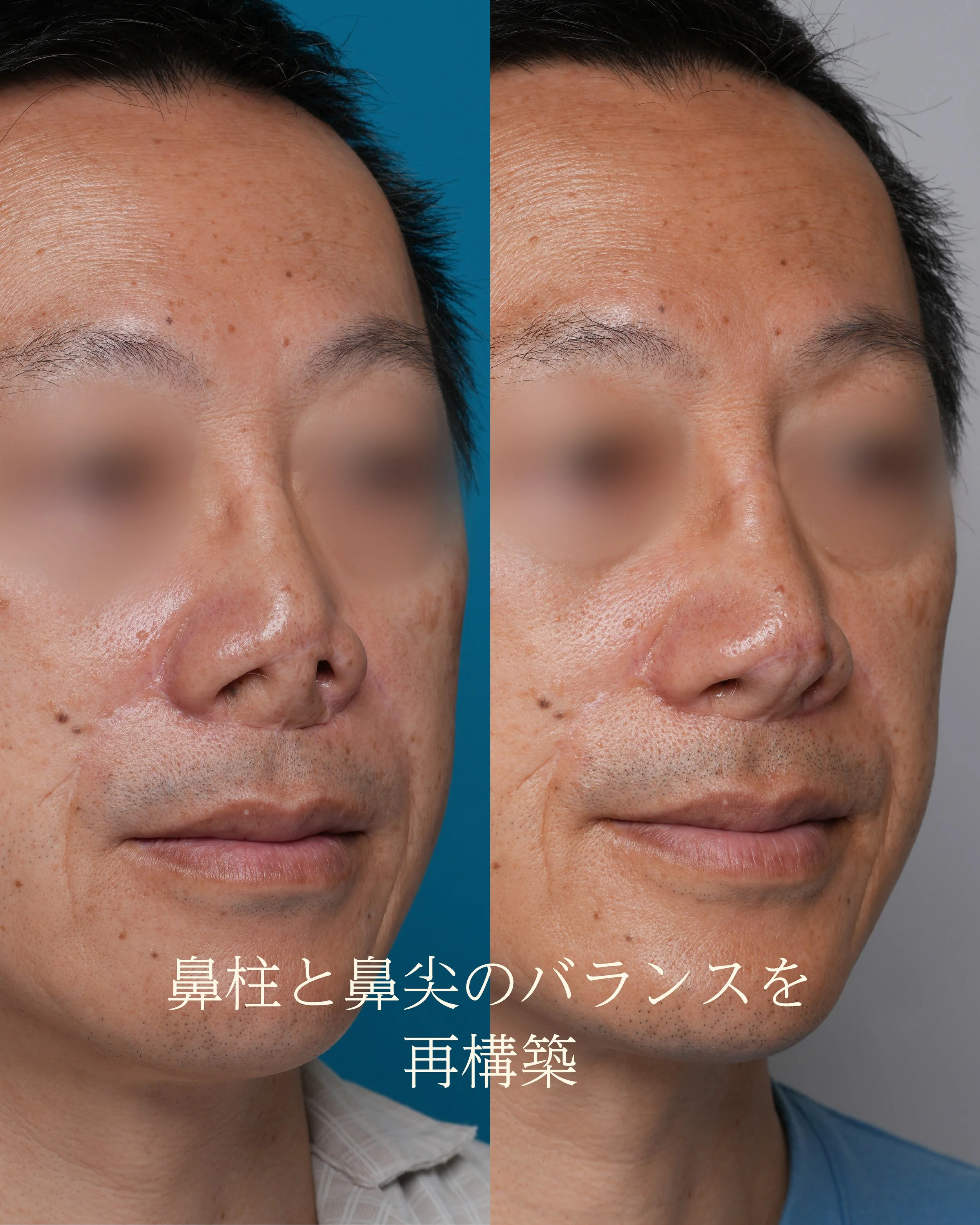 斜め