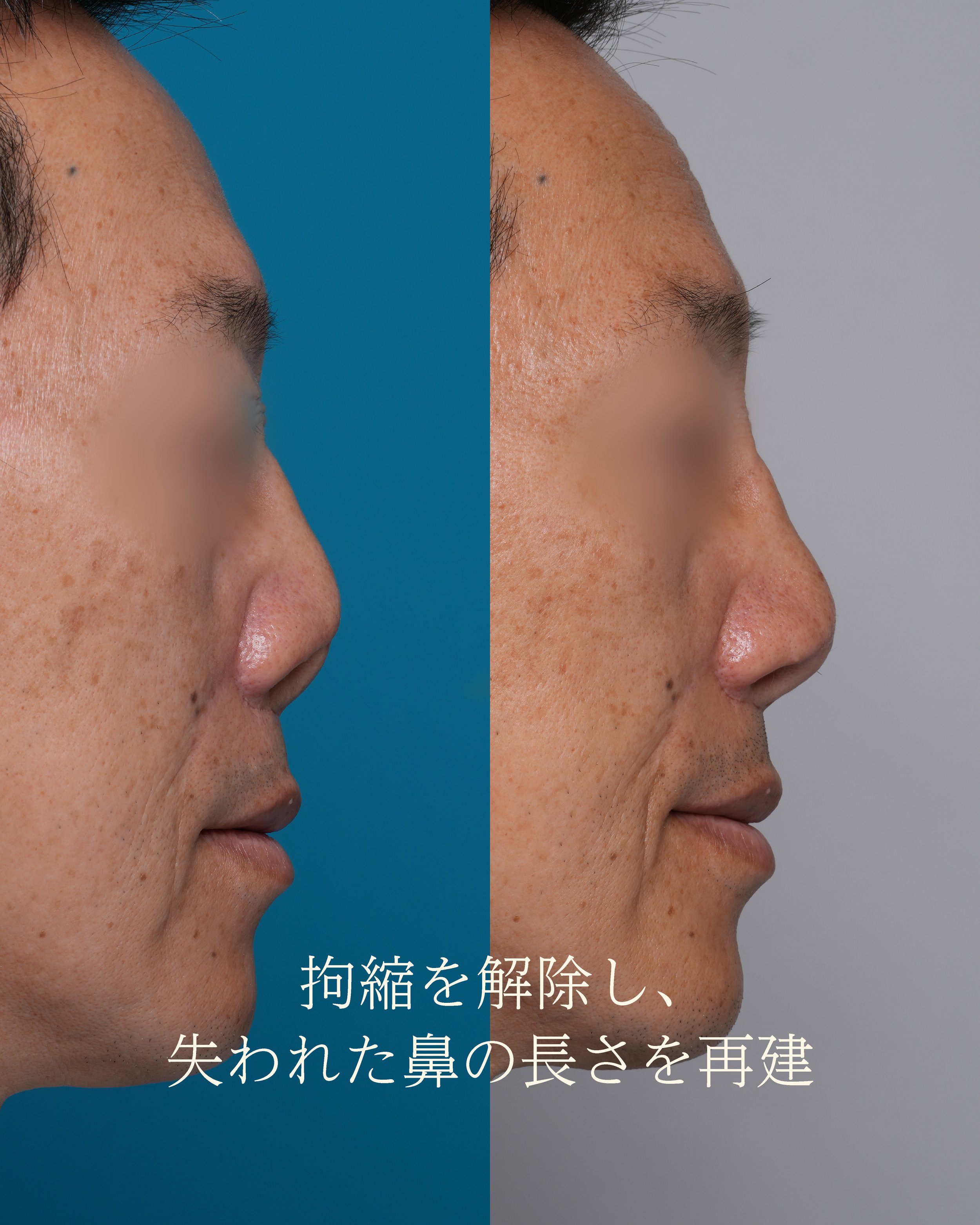 側面