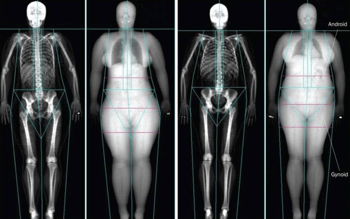 DEXA Body Composition Scans