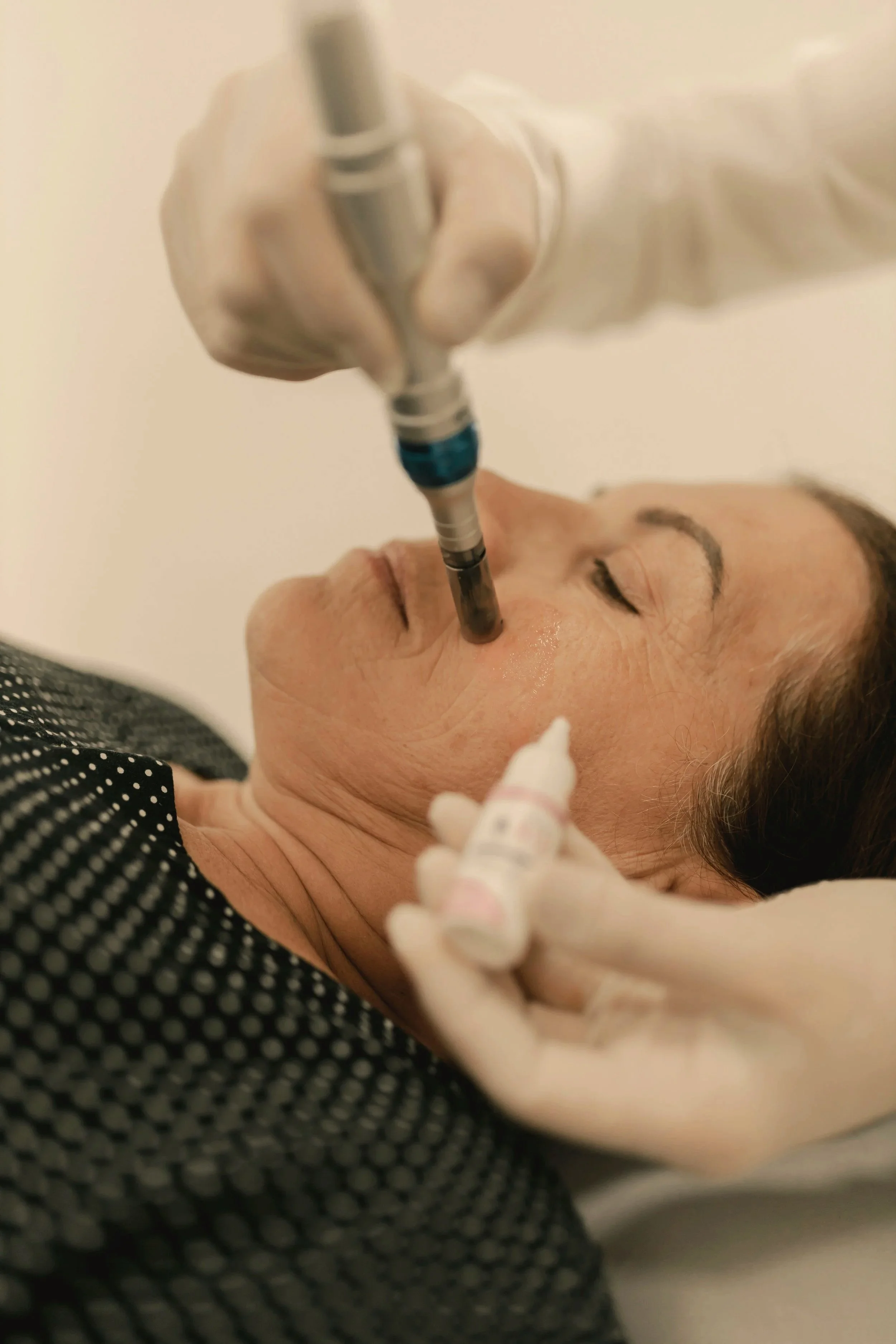 A medical professional using a micro needling pen device on a client's face during a treatment session
