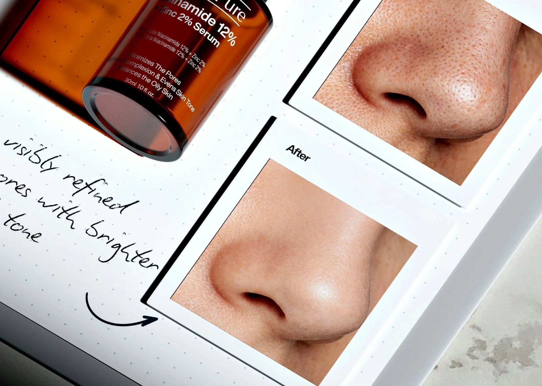 An image showing a zoomed in photo of a nice "before" treatment and another underneath "after" a treatment. The pores in the before picture are noticeably larger and the after picture looks less oily