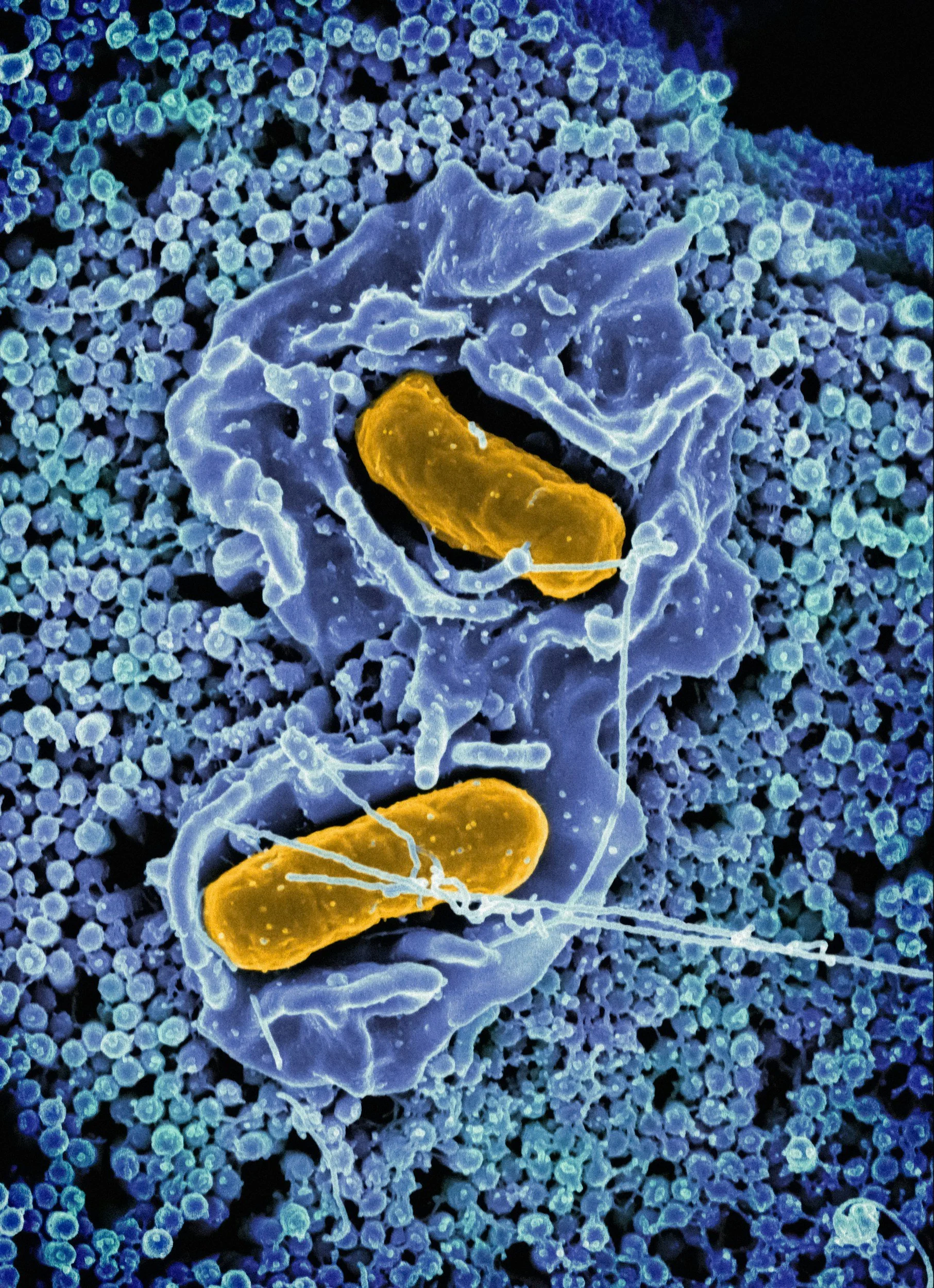 A colored scanning electron microscope image showing bacteria with rod-shaped bodies in yellow and blue, surrounded by numerous small spherical particles.
