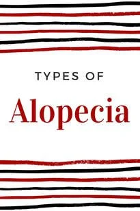 Types of Alopecia