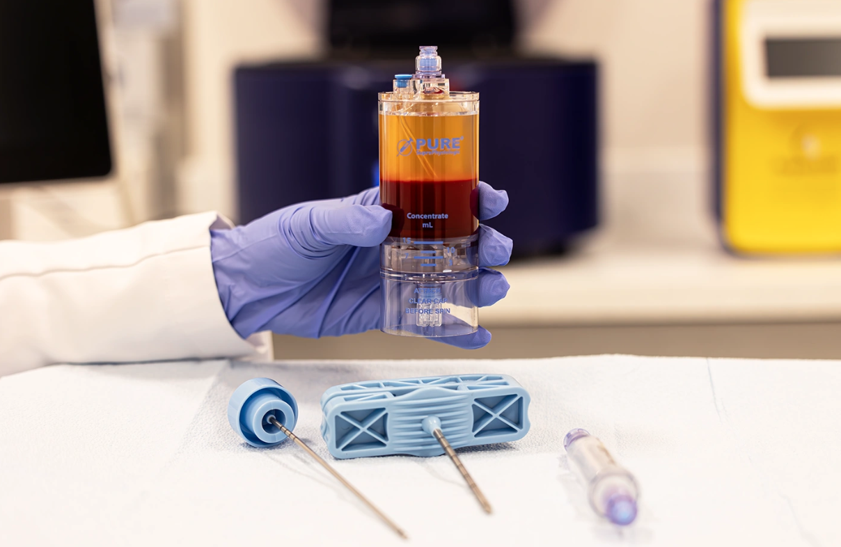 A gloved hand holding a syringe filled with blood in a laboratory setting. There are other medical instruments and containers on the table.