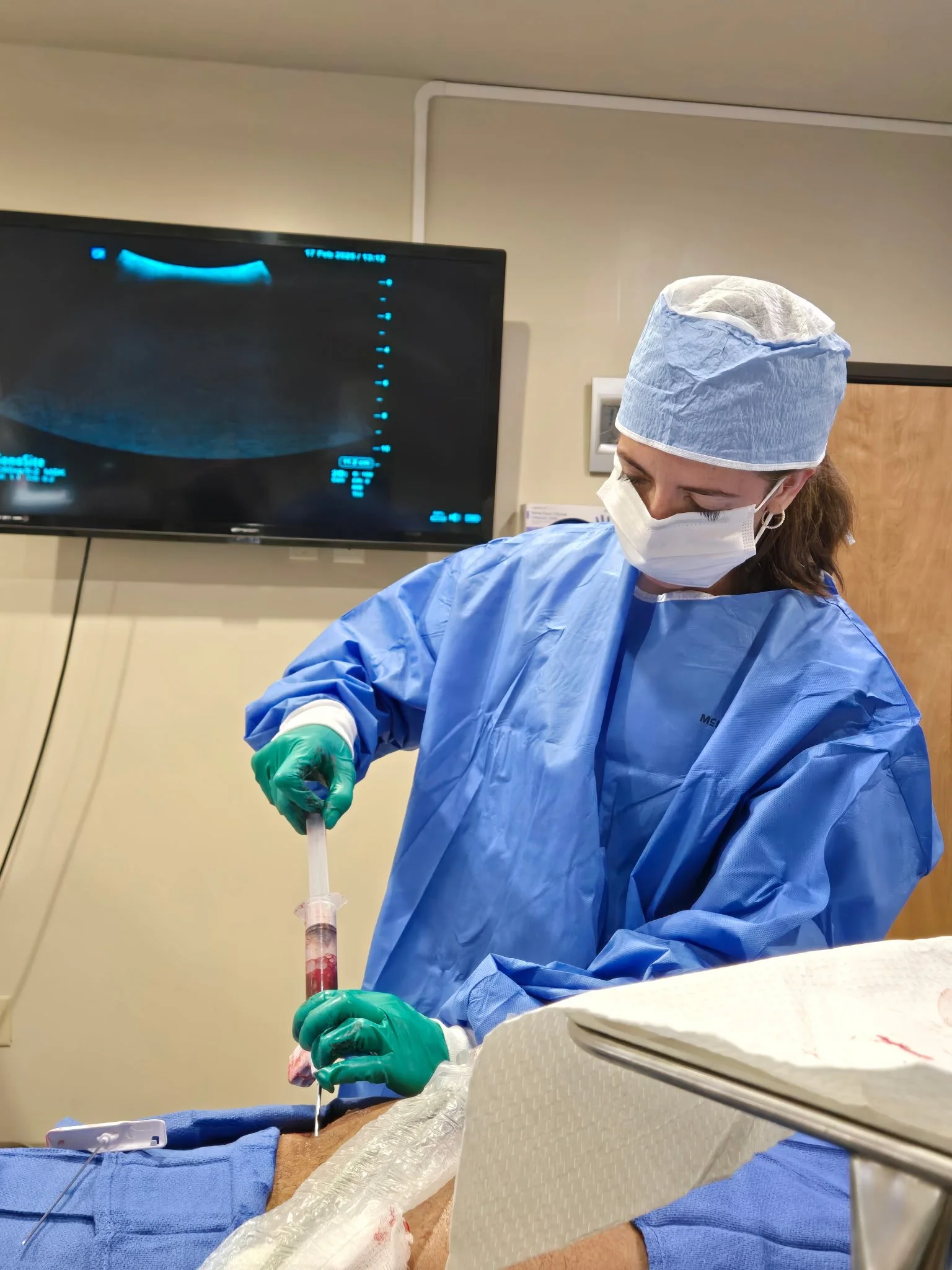 Dr. Melanie Worley performing a bone marrow aspiration for bone marrow concentrate (BMC) therapy using sterile technique.