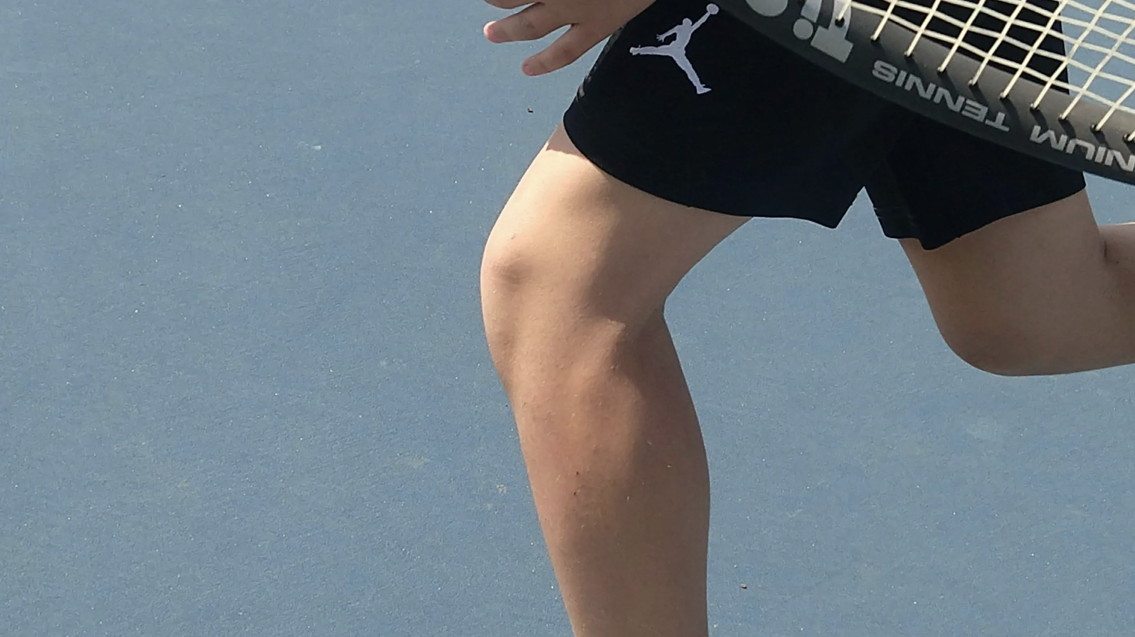 Osgood-Schlatter's Disease