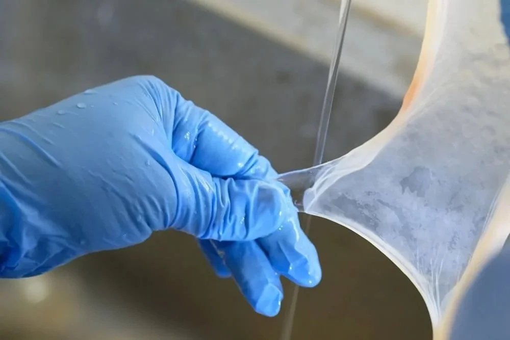 Advanced amniotic tissue therapy for chronic diabetic foot wounds, Westchester, NY Foot Doctor