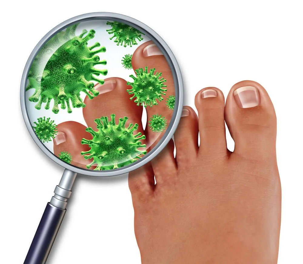 laser treatment for nail fungus at our westchester, ny podiatry practice.