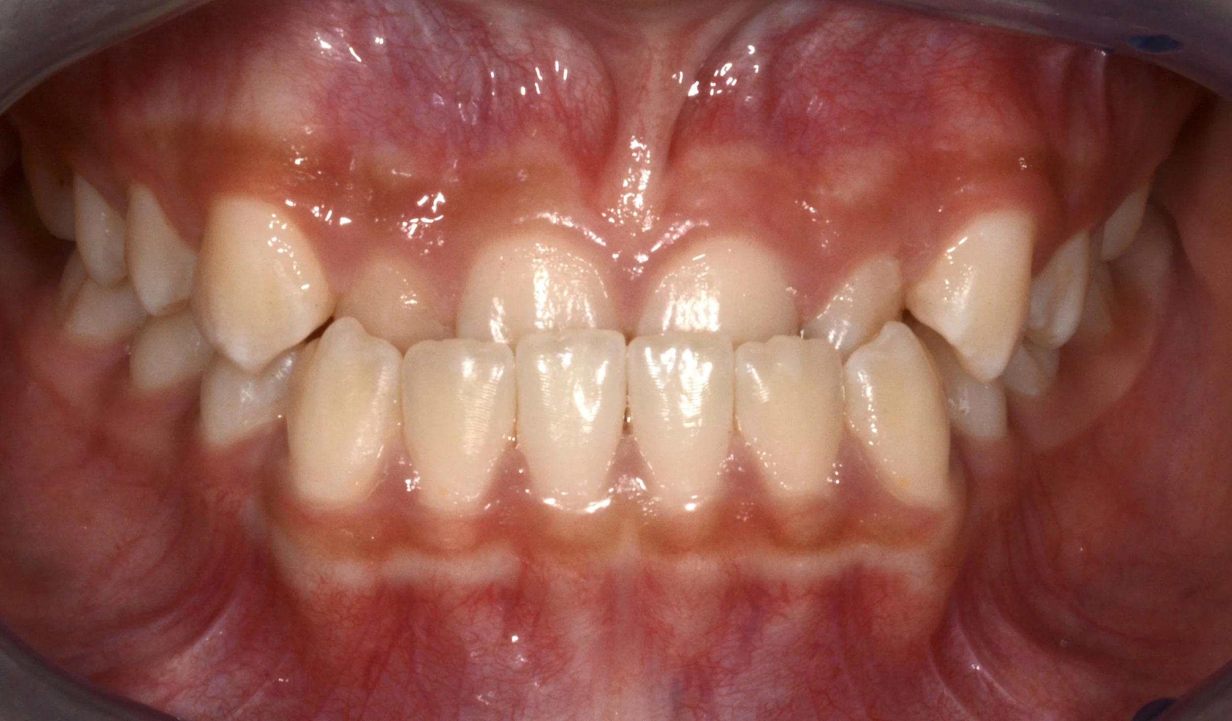 Close-up of an open mouth showing upper and lower teeth, pink gums, and inner cheeks.