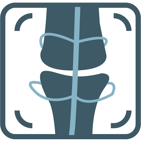 Musculoskeletal