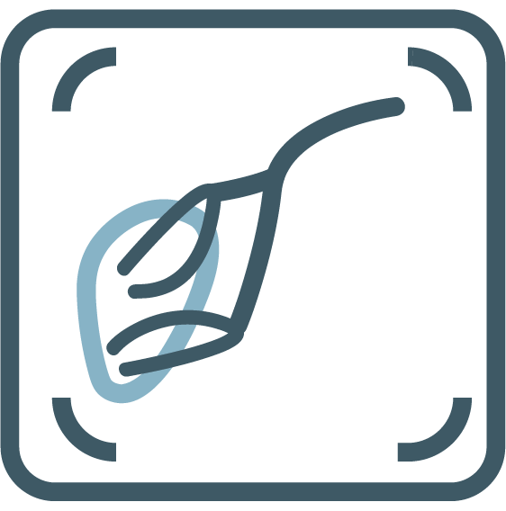 Prostate Artery Embolisation (PAE)