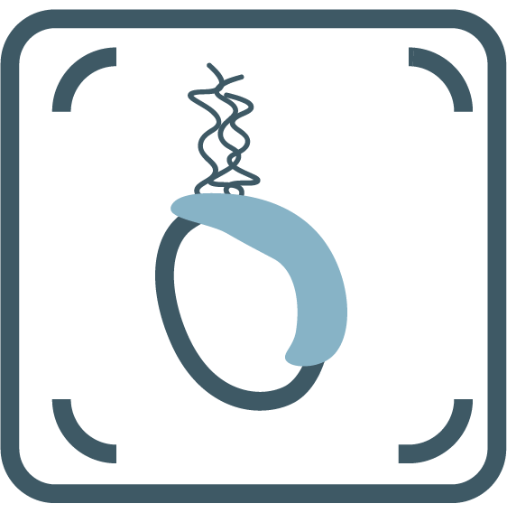 Varicocele Embolisation