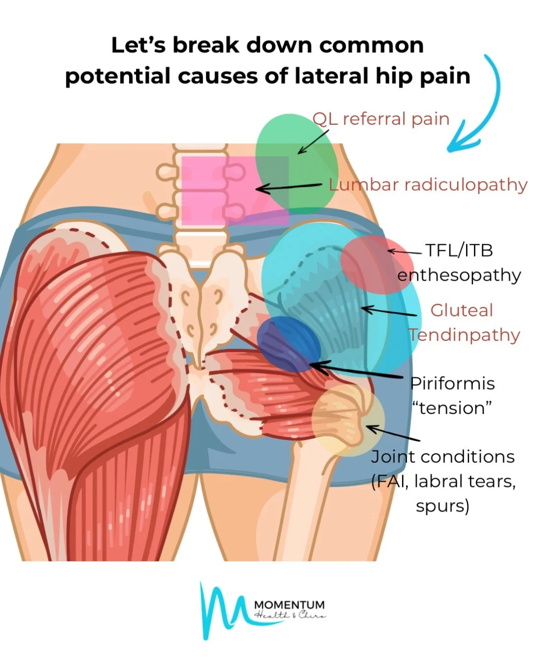 Are you experiencing hip pain that won&rsquo;t budge? 🙄

Lateral hip pain is quite a common symptom coming into the clinic right now.&nbsp; 
So, let&rsquo;s break it down a bit more, because not all lateral hip pain is the same or comes from the sam