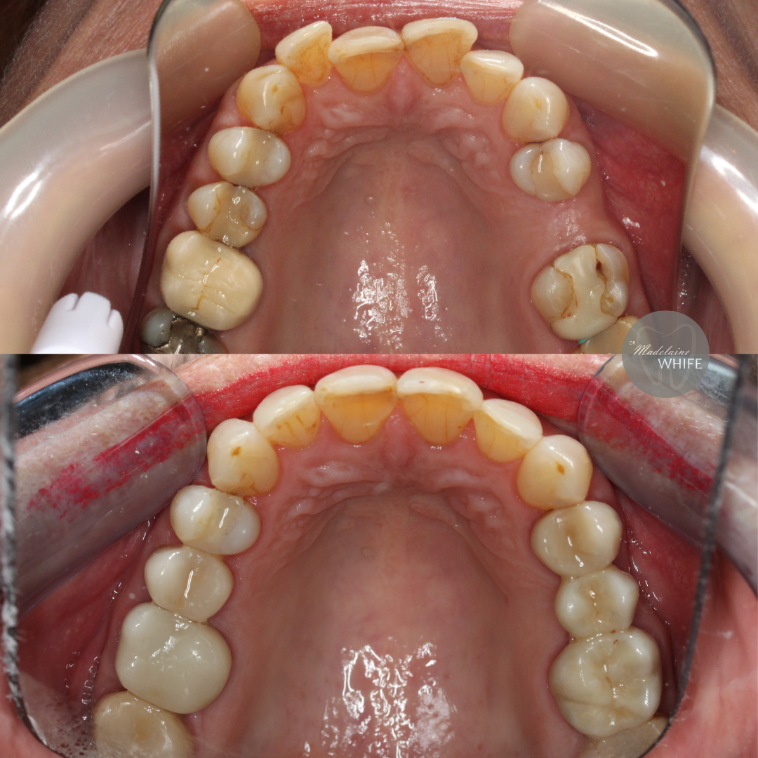 Top: Before.    Bottom: After.