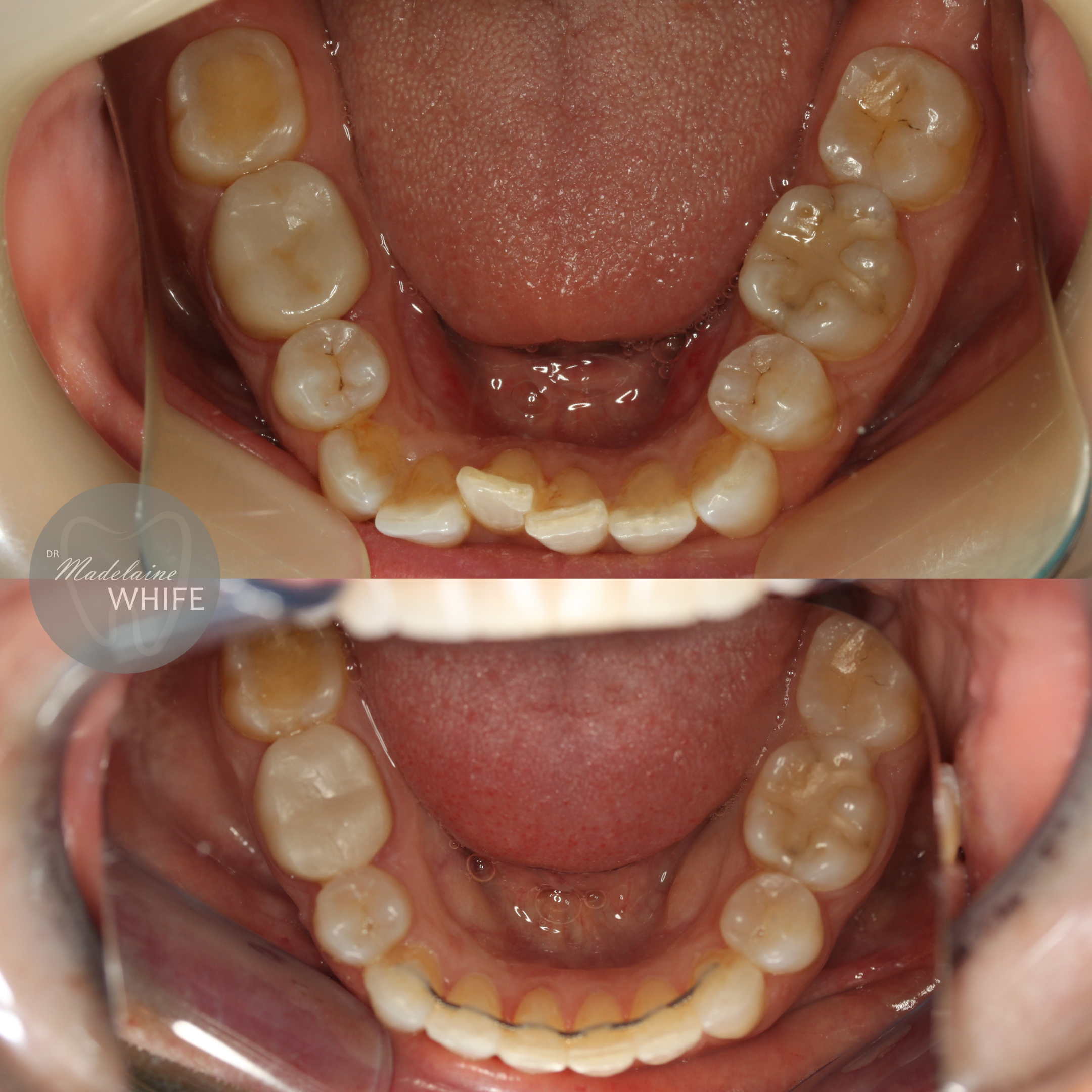 Top: Before.    Bottom: After.