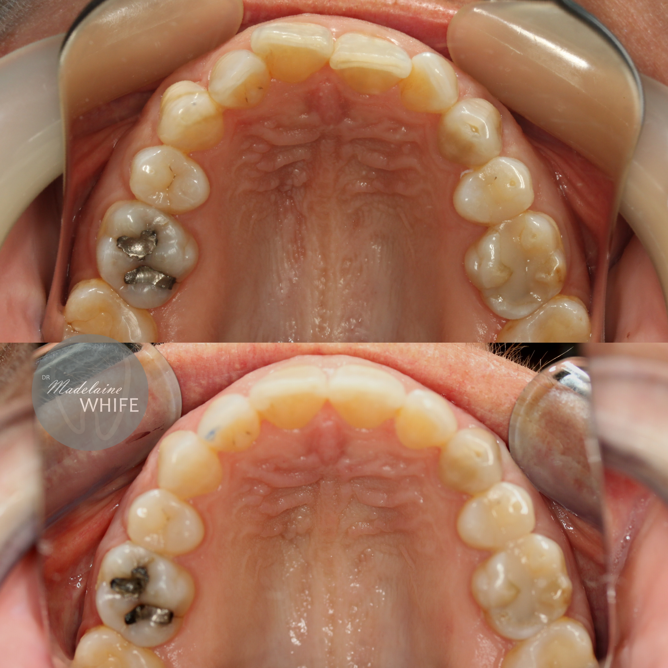 Top: Before.    Bottom: After.