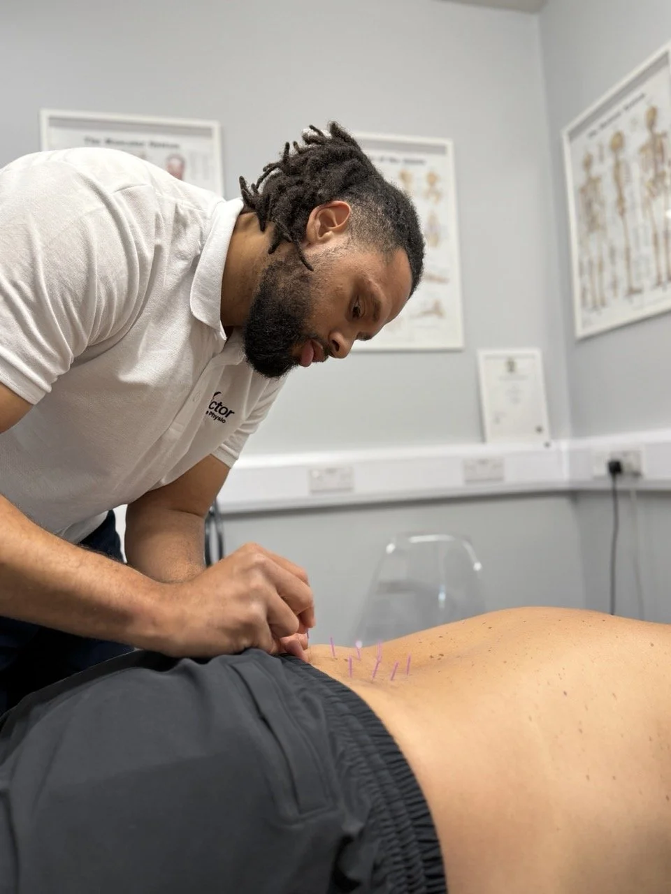 A physiotherapist performing acupuncture on a patient lying face down on a treatment table, with acupuncture needles inserted into their back, in a consultation room with anatomical posters on the wall.
