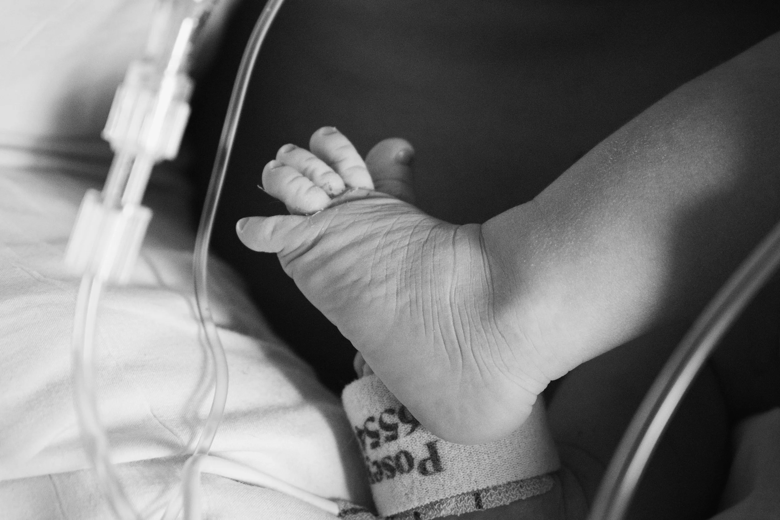 Close-up of a person's hand with veins and wrinkles, resting on their lap, wearing a patterned garment, with medical or electronic equipment nearby.