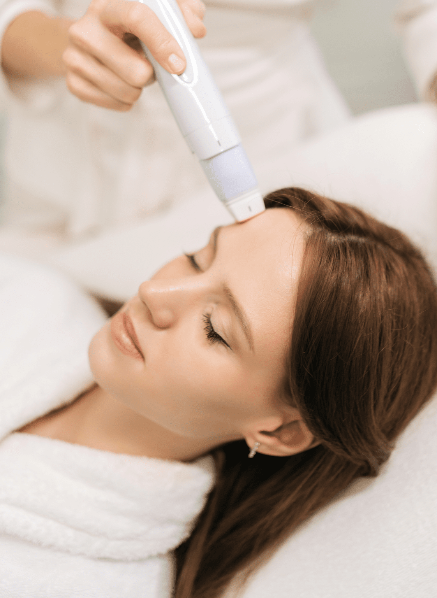Microneedling treatment