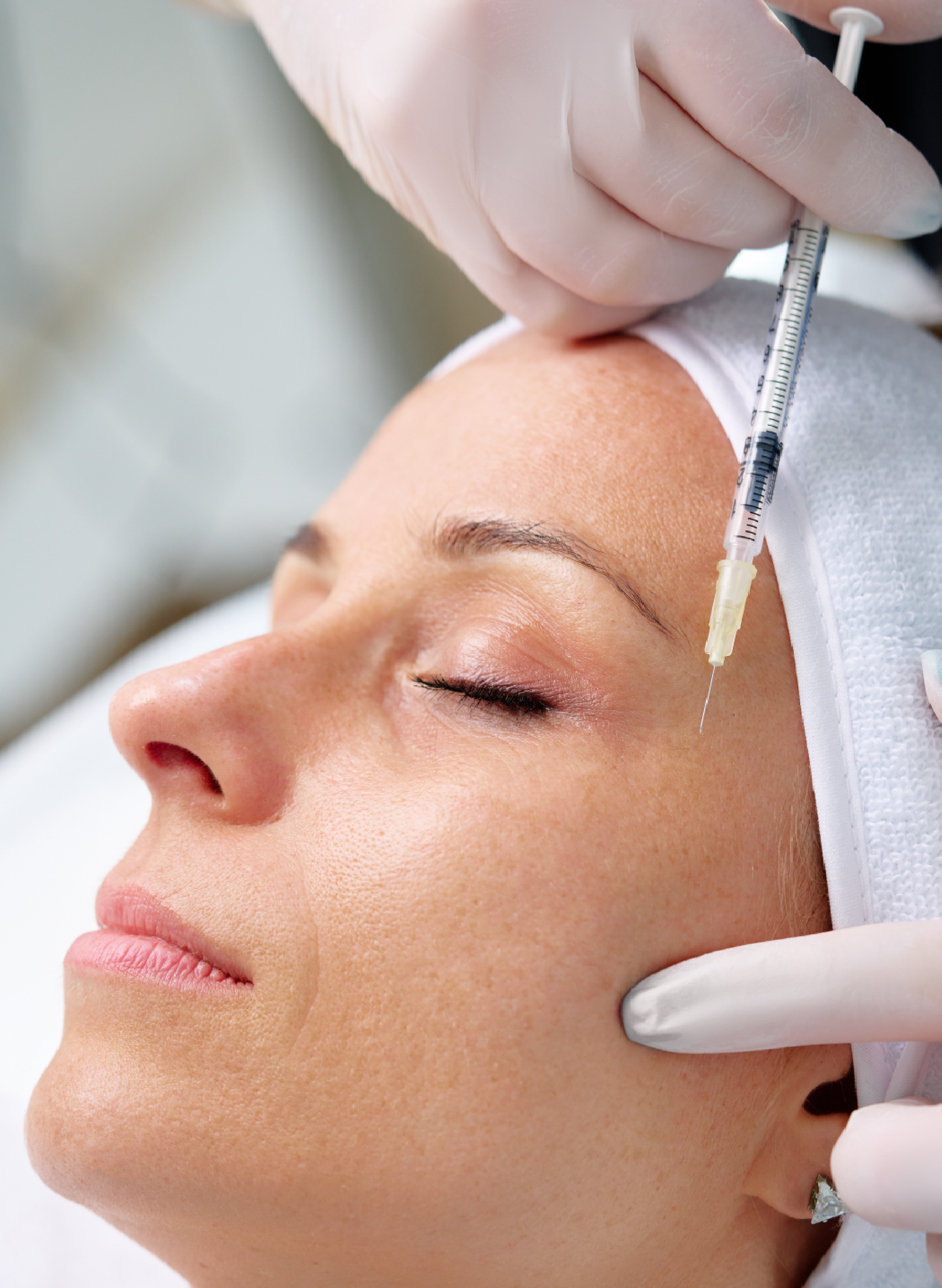 Botox treatment