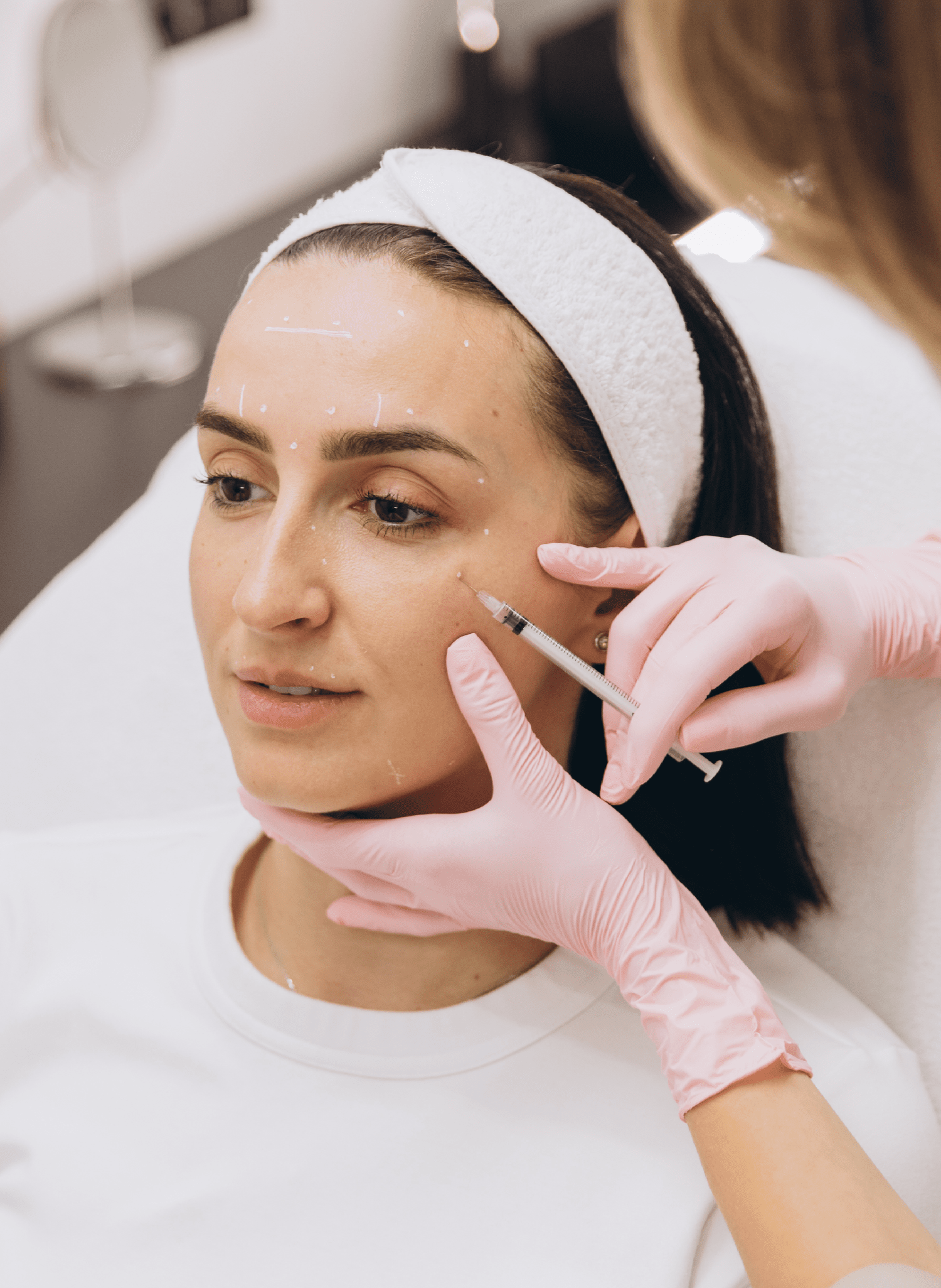 Dermal filler treatment