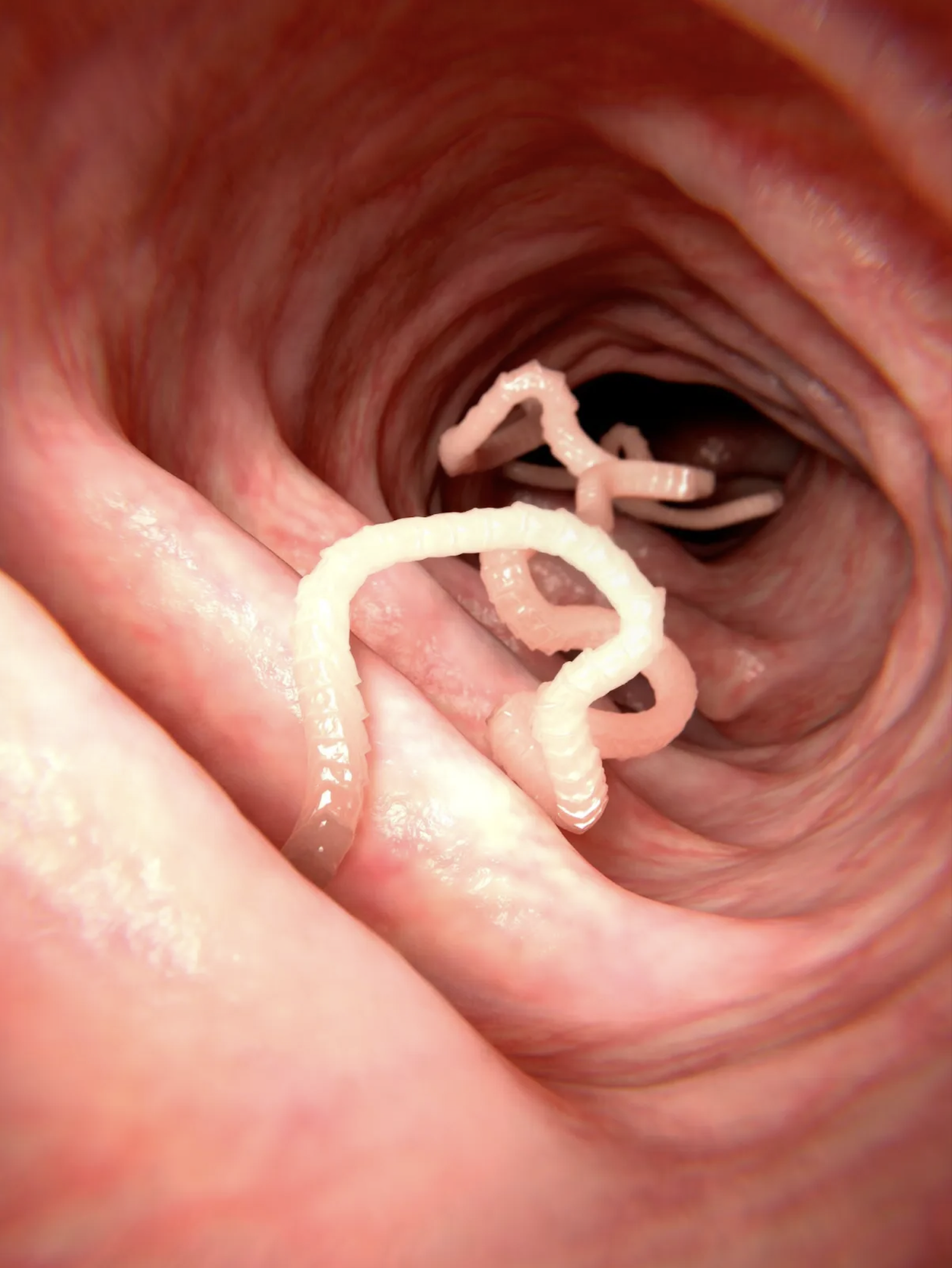 Close-up view of the interior of a human mouth showing pinkish tissue and some white and pink worms.