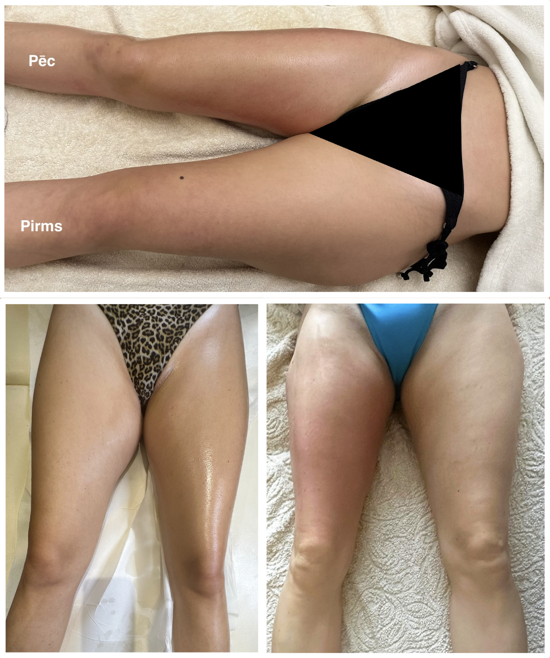 Close-up of two pairs of legs lying down, one with a leopard print swimsuit and shiny skin, and the other in a blue swimsuit with slightly textured skin. The top image shows the inner thighs, labeled 'Péc' and 'Pirms'.