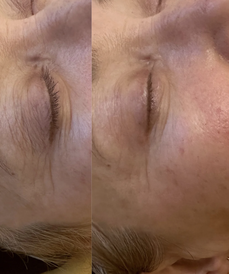 Close-up of a person's face focusing on the eye area, showing skin details and textures.