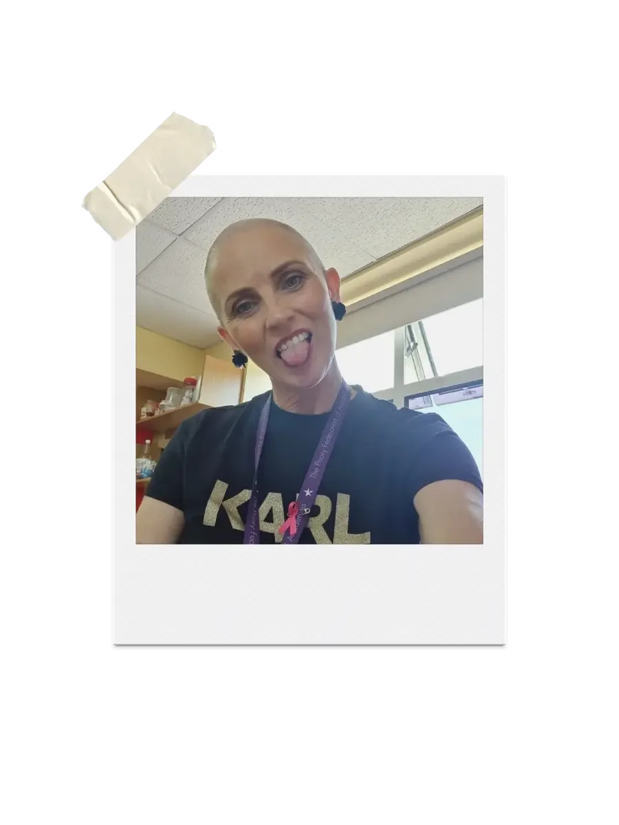 Polaroid photograph of Rhonda, founder of Flossie & Locke, sticking out her tongue with a shaved head during chemotherapy treatment.
