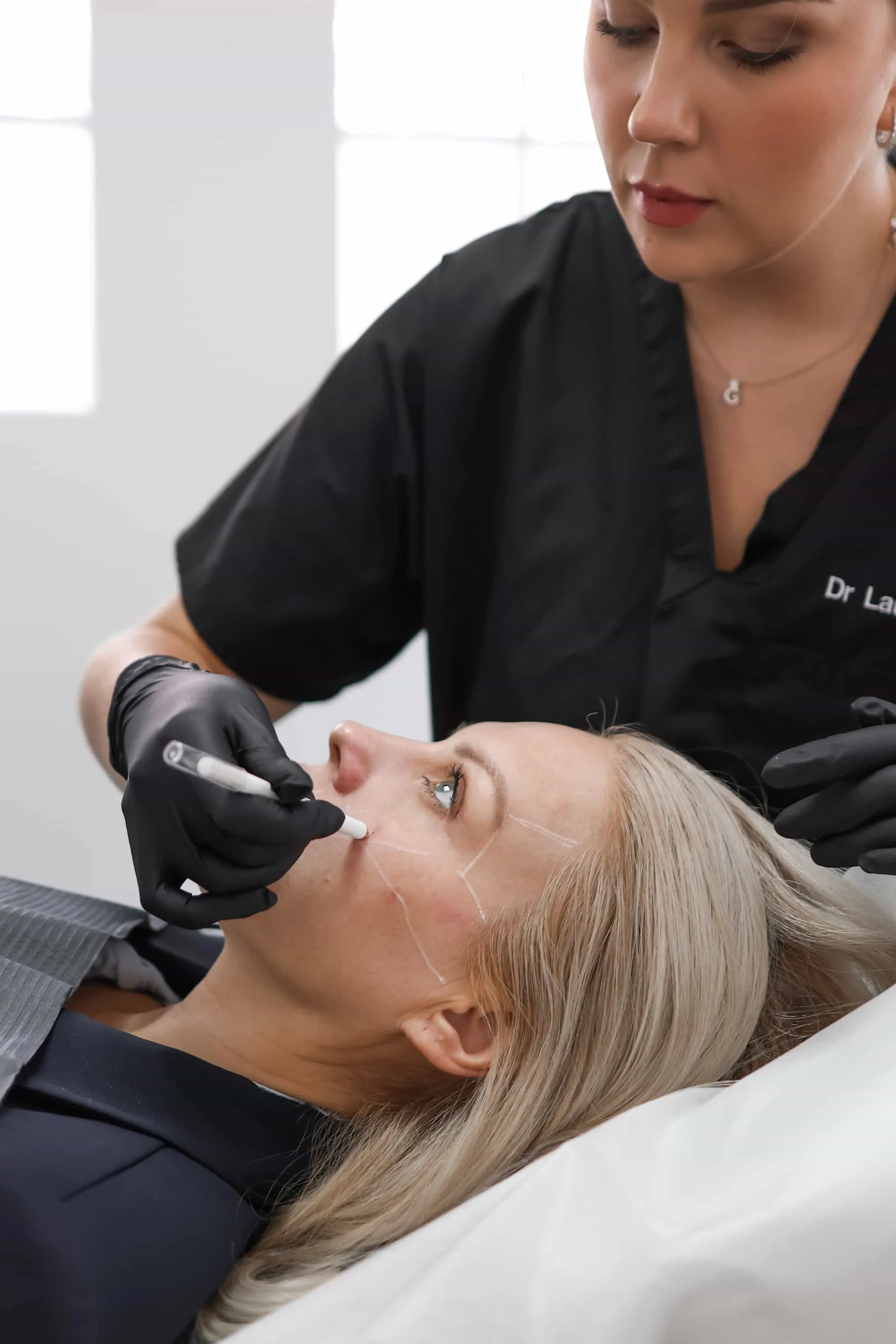 Una mujer con cabello rubio claro descansando en una camilla, mientras una profesional realiza un procedimiento estético en su rostro usando un bolígrafo de microagujas, vestida con un uniforme negro y guantes negros.