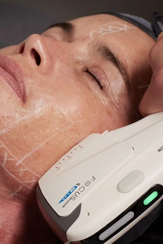 HIFU Facial