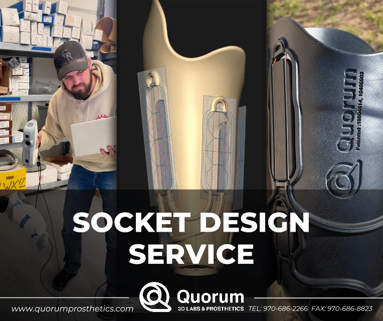 Socket Design Service graphic showing Quorum’s engineering process, including 3D scanning a prosthetic leg, designing a prosthetic socket in CAD, and holding a finalized 3D printed Quatro Socket.