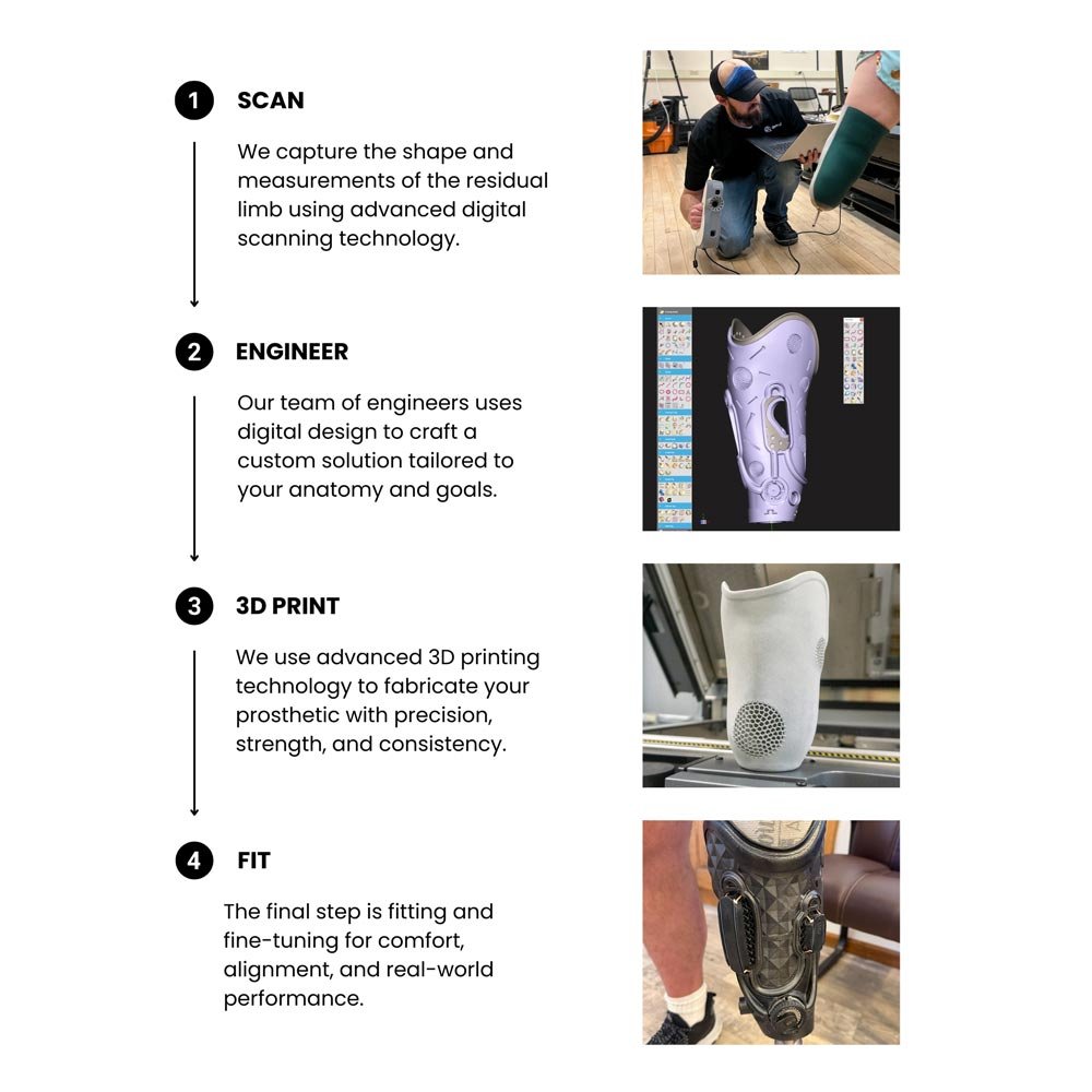 Step-by-step prosthetic fabrication process showing scan, engineering, 3D printing, and final fitting.