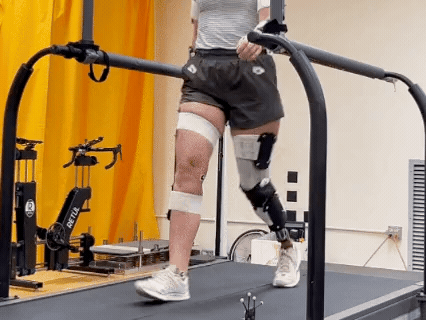Animated GIF showing a person with a lower limb amputation walking on a treadmill with a Quatro Socket during gait symmetry testing at CU Boulder’s Applied Biomechanics Lab.