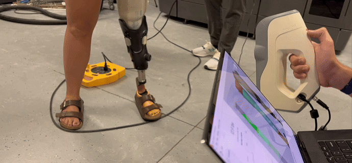 Existing prosthetic socket being scanned to capture its shape and design details for digital review and fabrication.