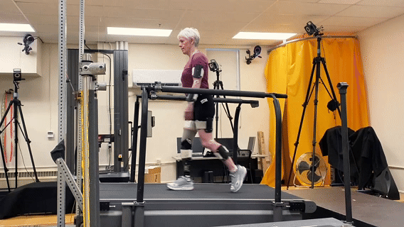 Amputee wearing a Quatro Adjustable Socket walking on a treadmill at CU Boulder’s Applied Biomechanics Lab to record gait symmetry.