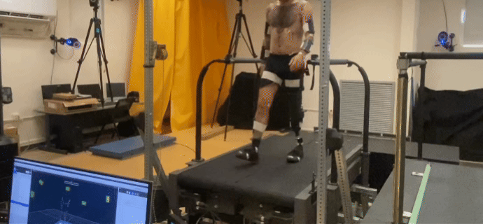 Person wearing a Quatro Adjustable Socket walking on a treadmill at CU Boulder’s Applied Biomechanics Lab while a computer records gait symmetry data.
