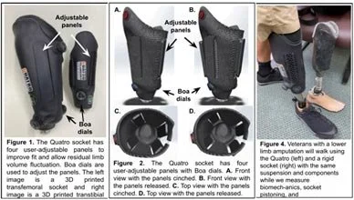 Effects of the Quatro Socket on Gait Symmetry in Adults with Transfemoral Amputation