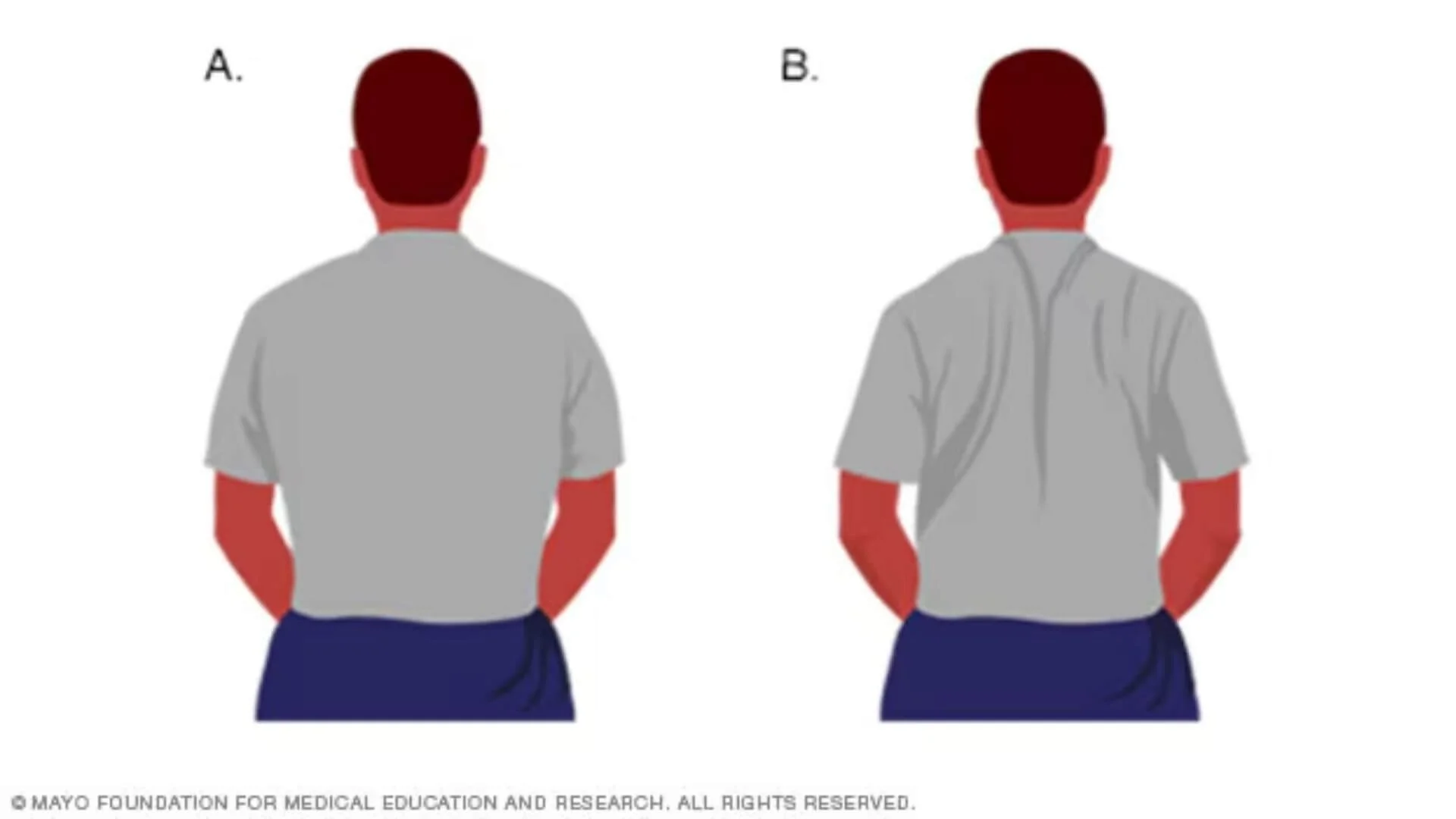 graphic showing how to do the Shoulder Blade Squeeze