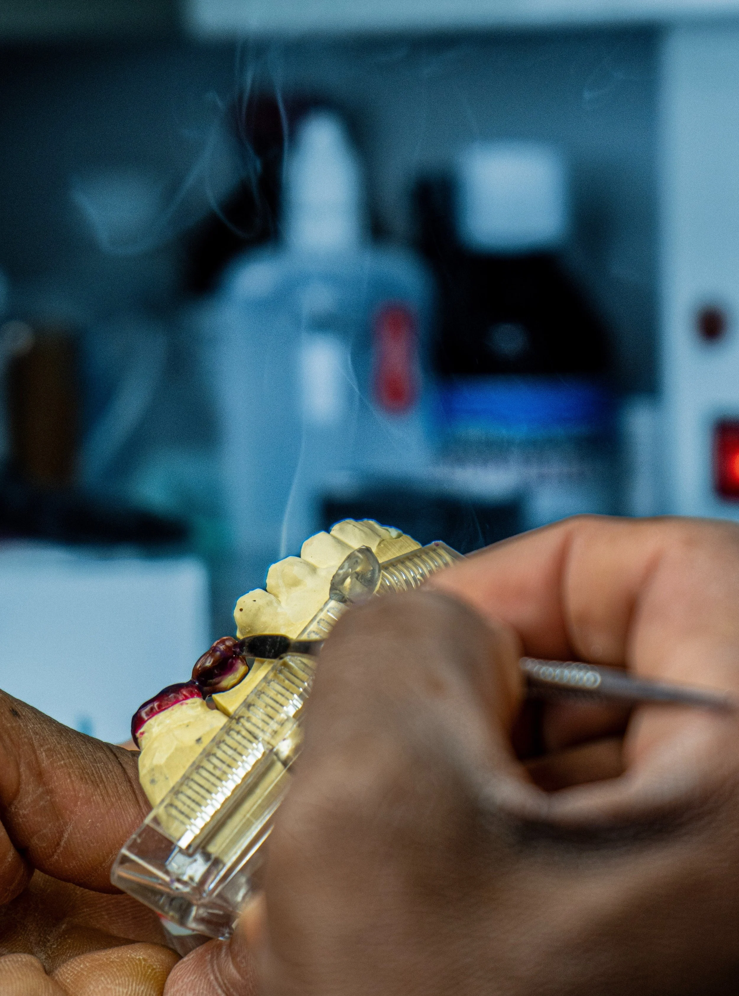 Our technicians combine decades of experience with modern techniques to create restorations that complement your preparation, fit predictably and look natural in the mouth.

At ADG Dental Services, we&rsquo;re dedicated to giving our dentist customer