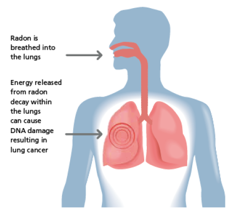 Diagram showing how radon is inhaled into the lungs and its potential to cause DNA damage leading to lung cancer.
