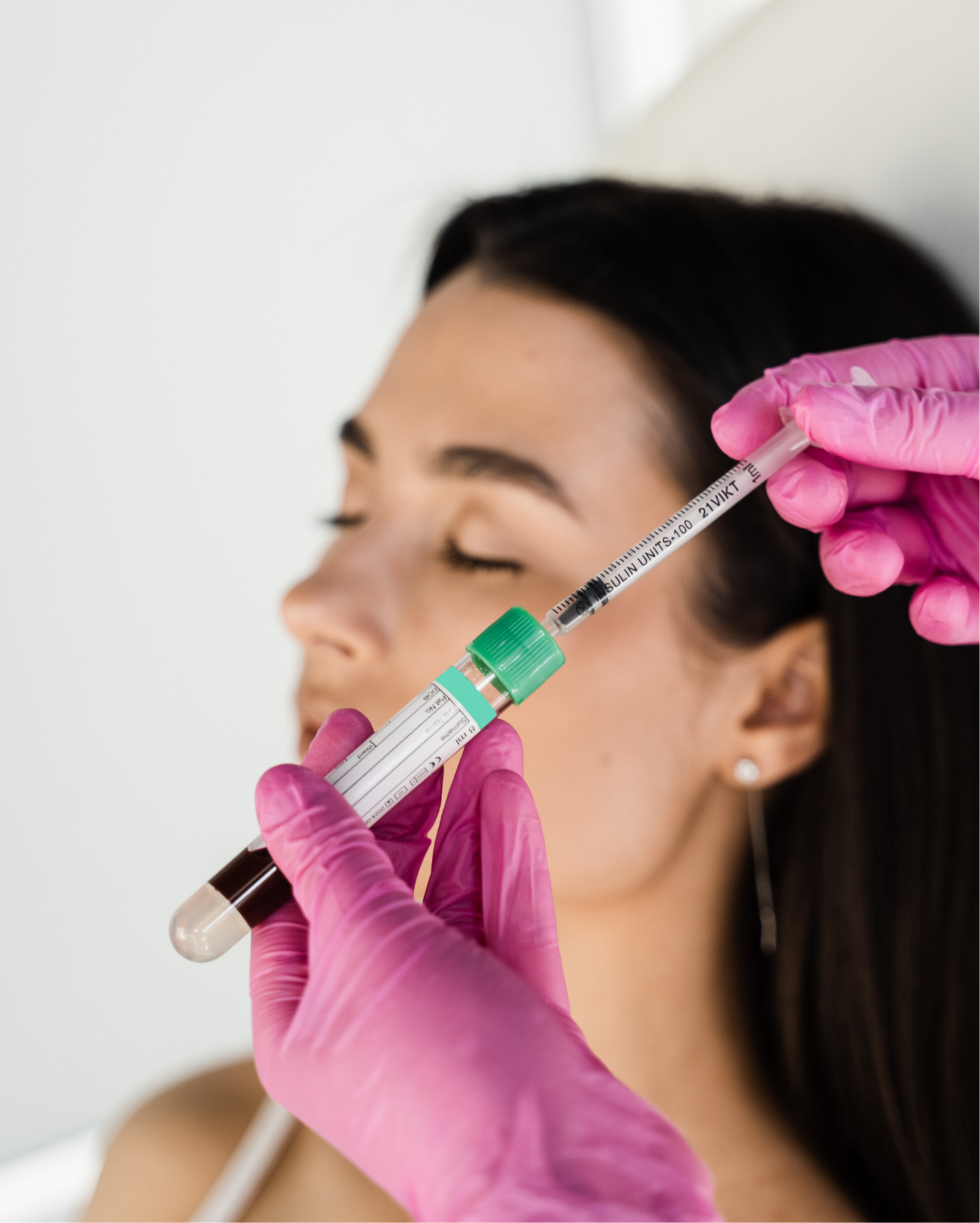 Medspa in Sherman Oaks, CA 91403 l PRP Near Me