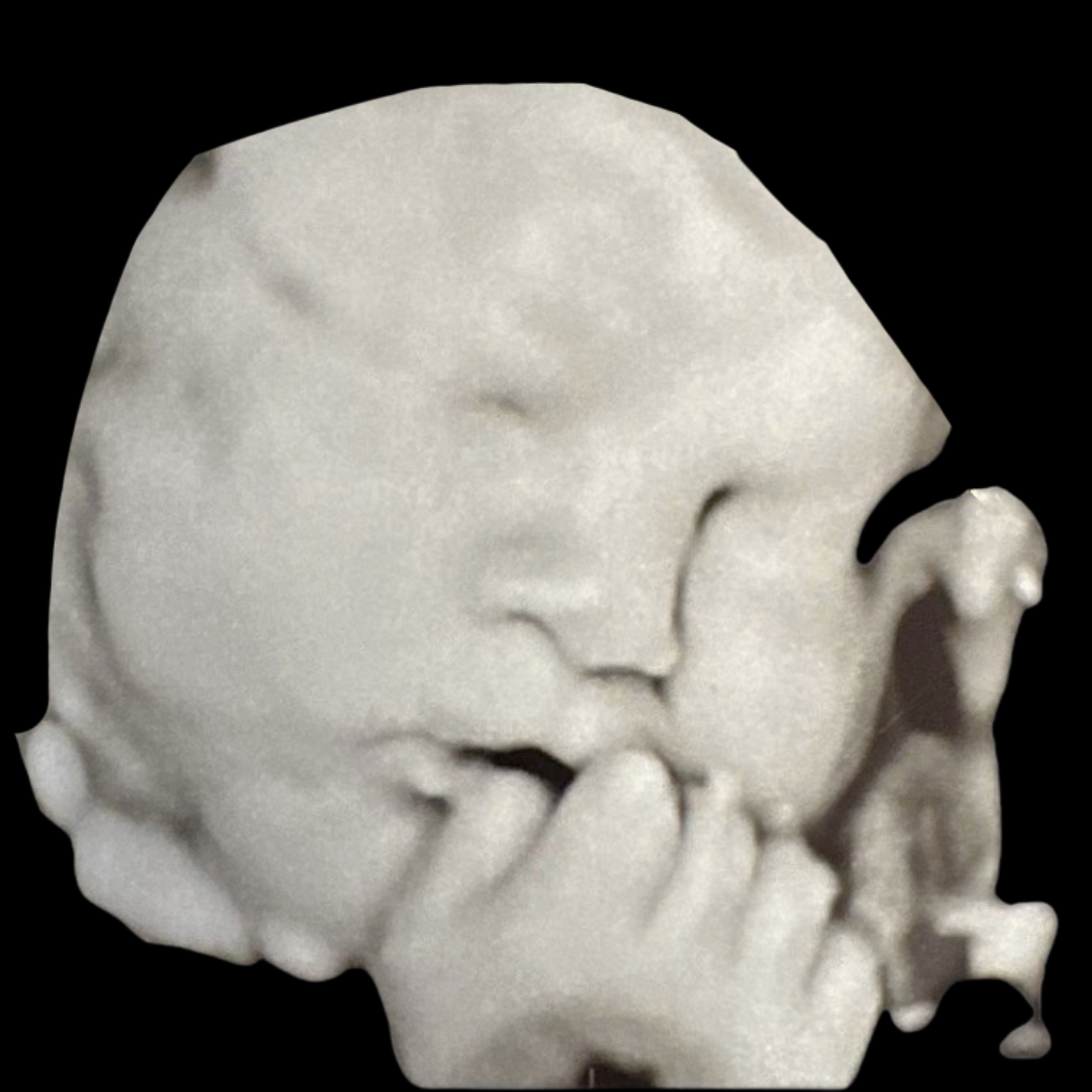 How To Prepare for Your 3D/4D Ultrasound 