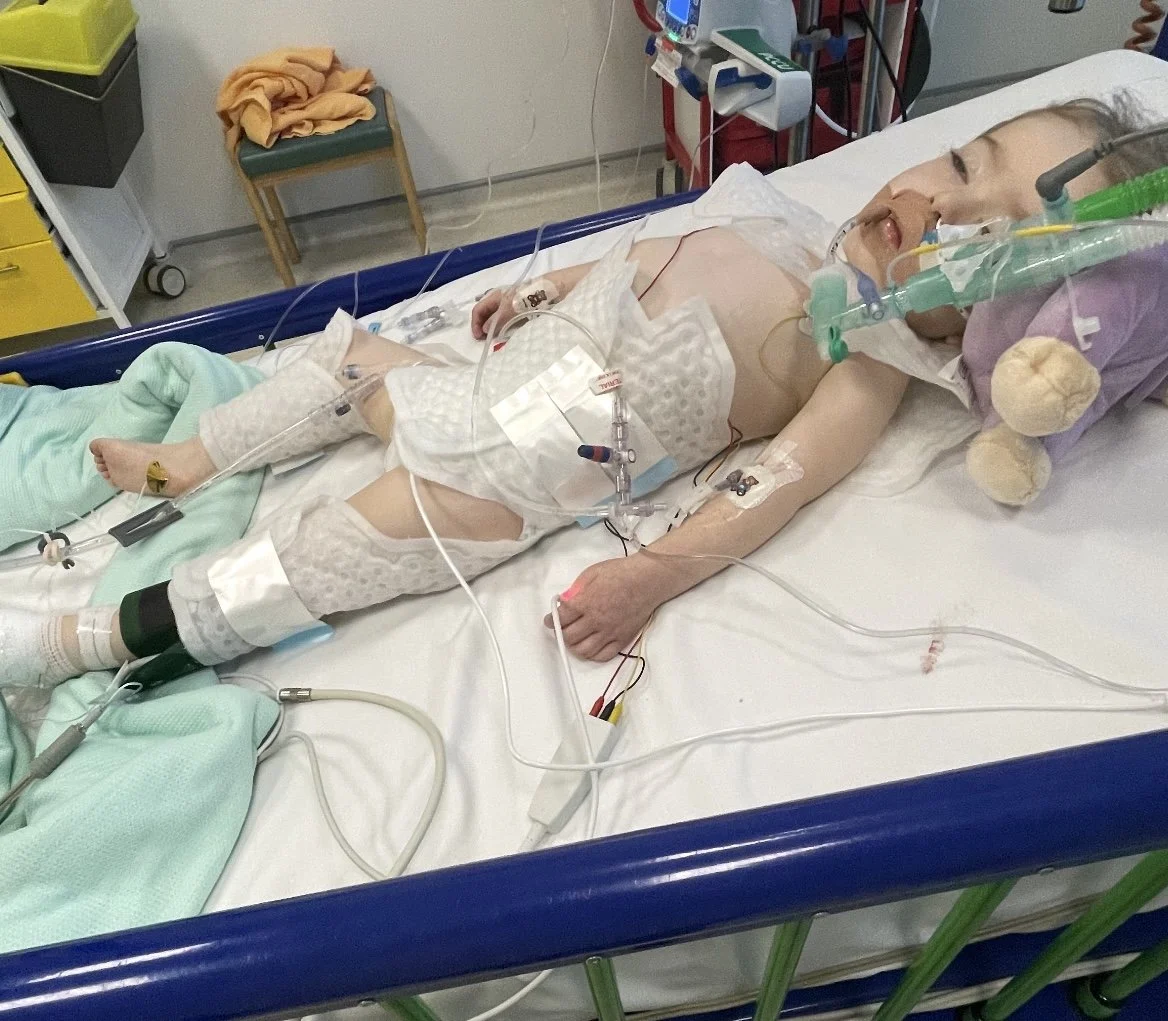A young boy lying in a hospital bed connected to medical equipment and tubes, smiling and seemingly awake.