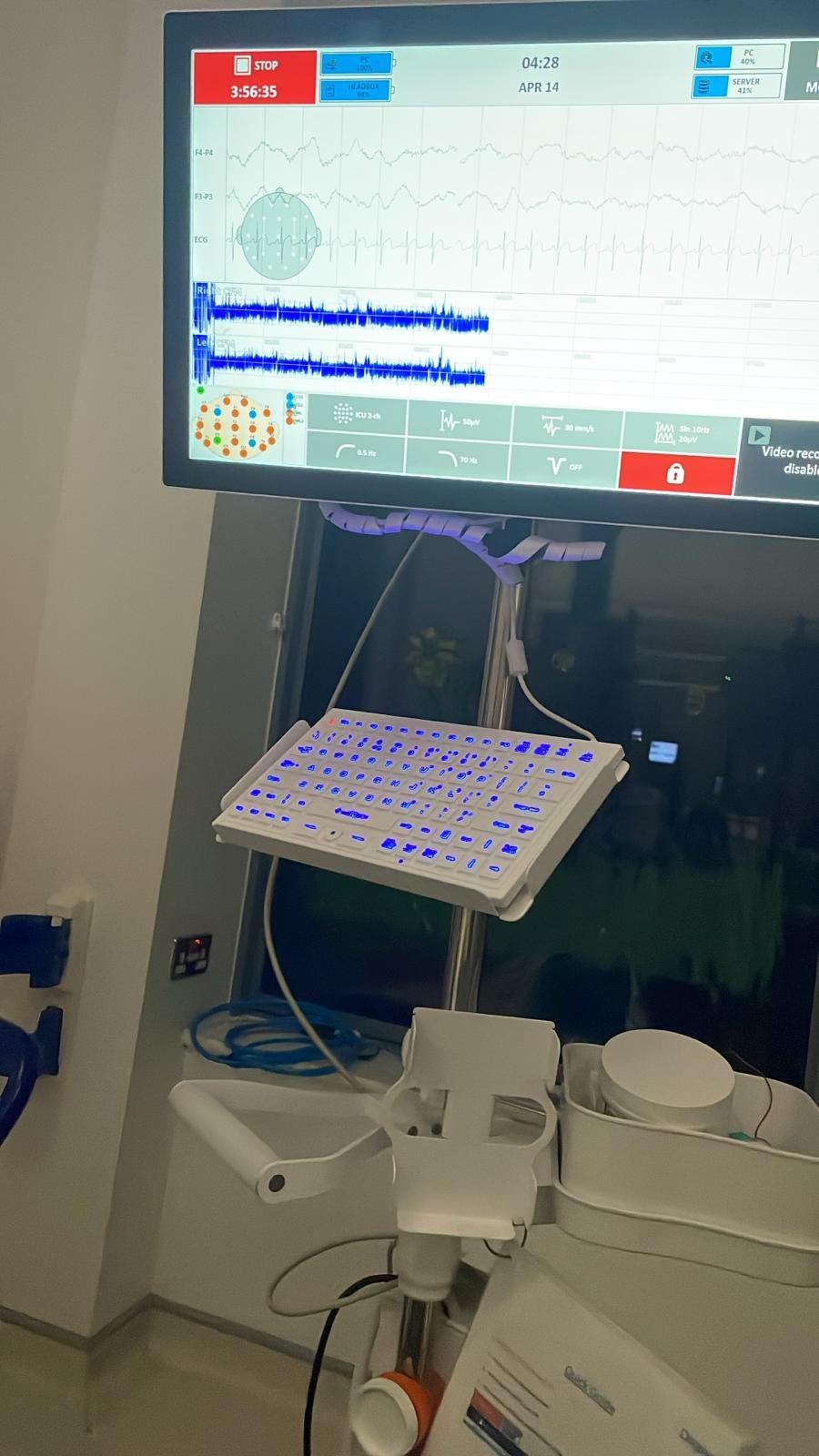 Medical monitor displaying heart rate and EEG data, with a keyboard, medical equipment, and a tray underneath in a hospital setting.