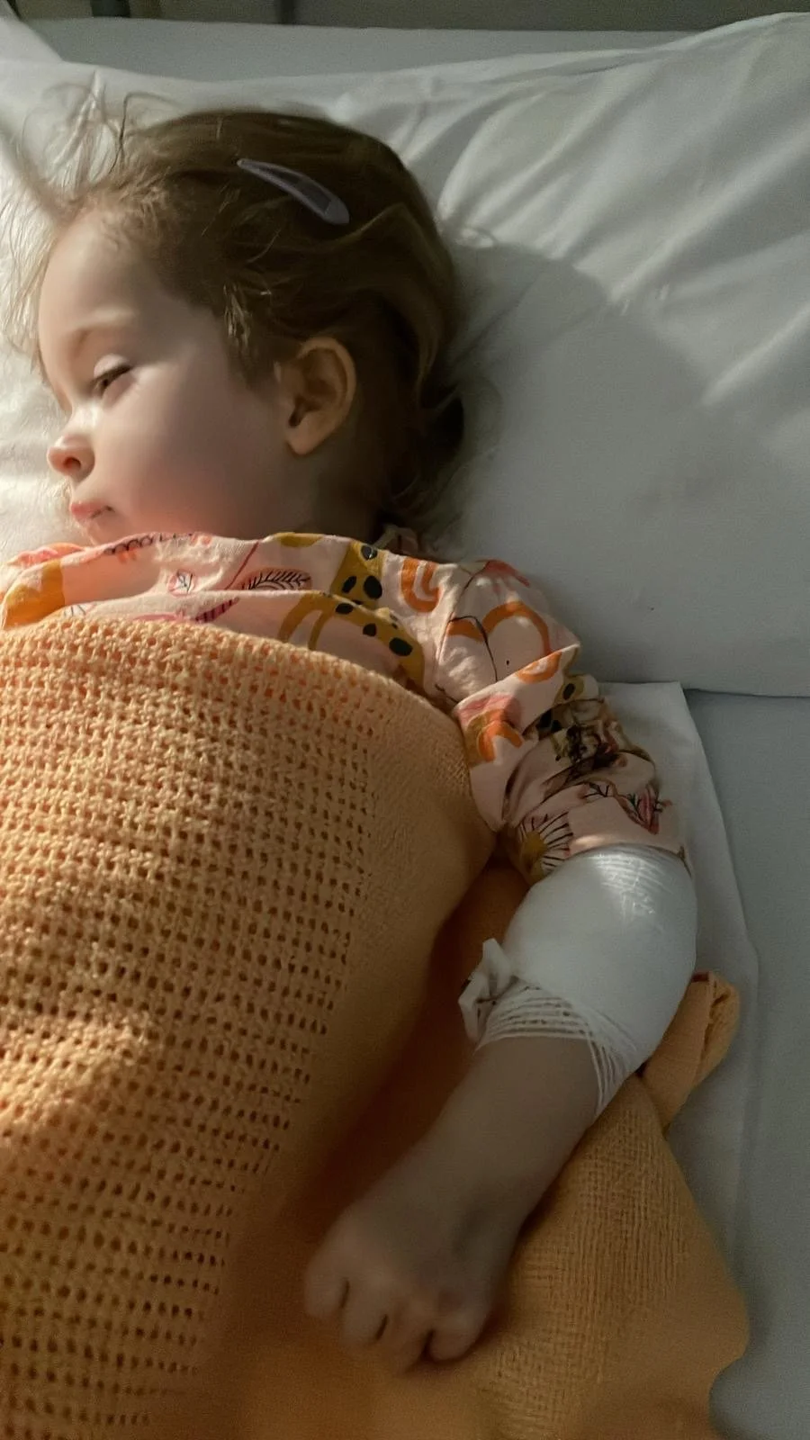 A young girl with a hospital bandage on her arm, lying in bed and wearing colorful pajamas, resting with her head on a pillow.