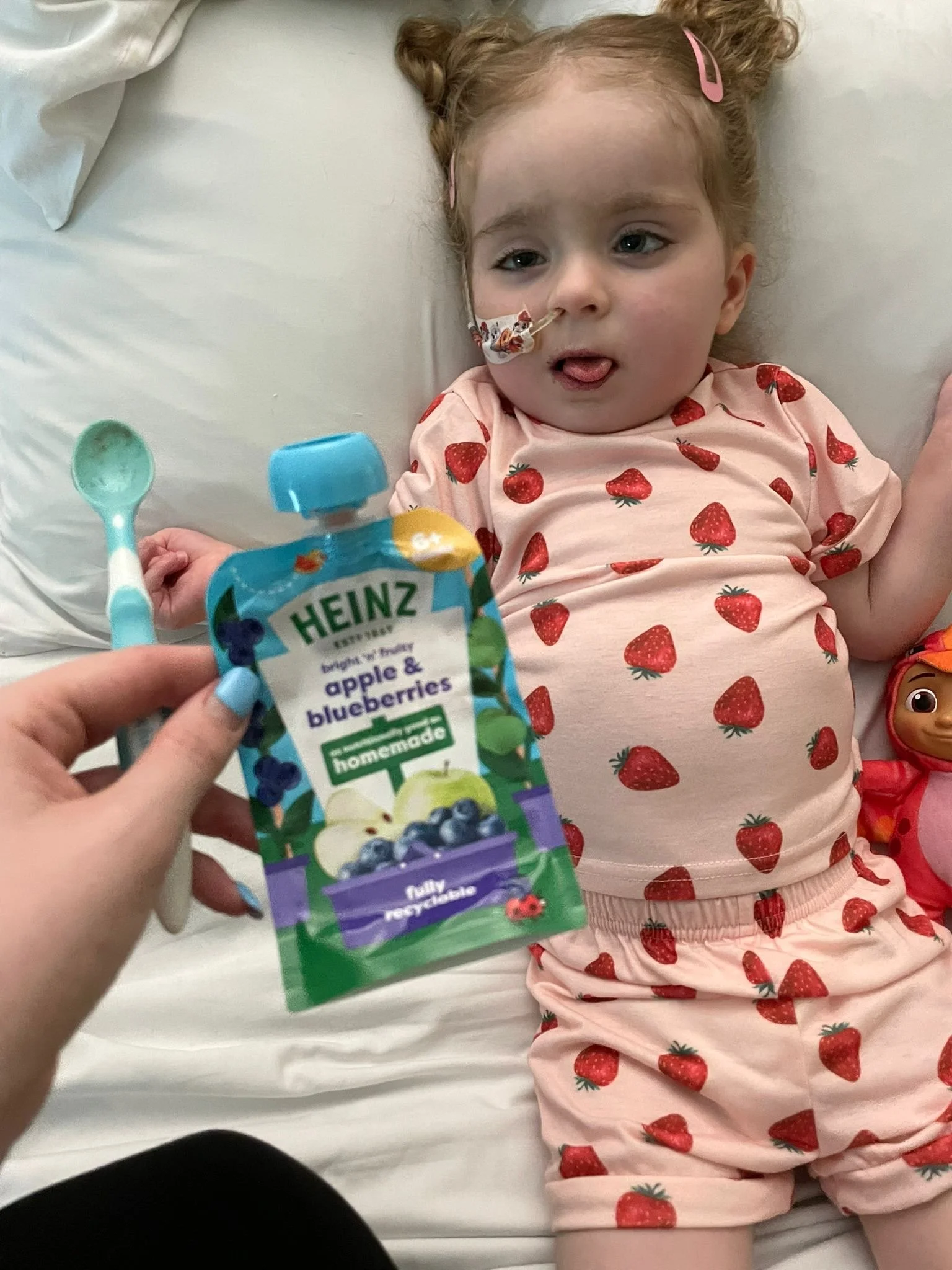 A young girl lying in a hospital bed with a nasal cannula. She is wearing a pink outfit with strawberries printed on it and has pink hair clips. A person is holding a pouch of Heinz apple & blueberry baby food in front of her.