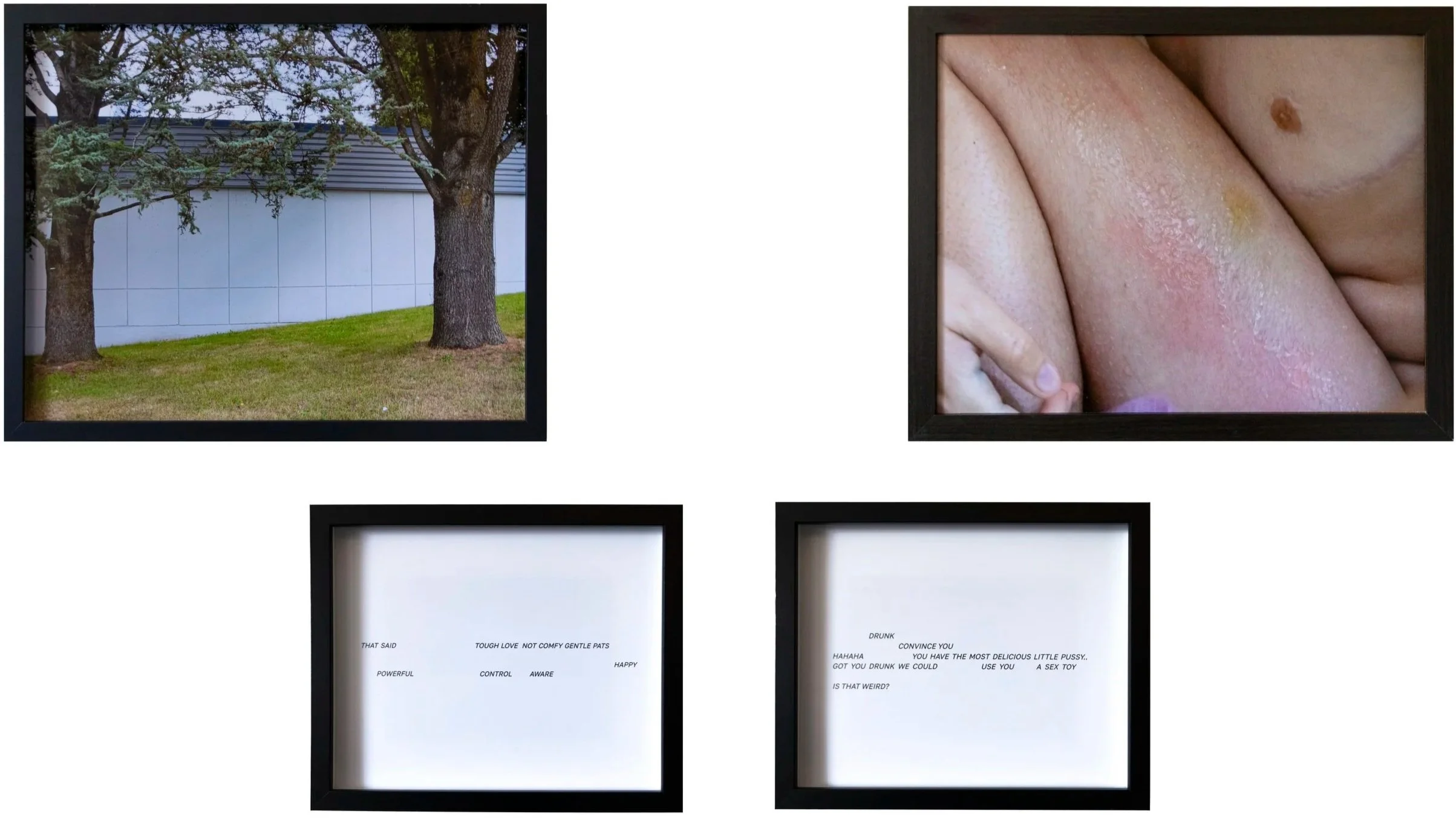 Two framed pictures, one of trees and a building exterior and another of close-up skin with a mole and pink-red blemish.