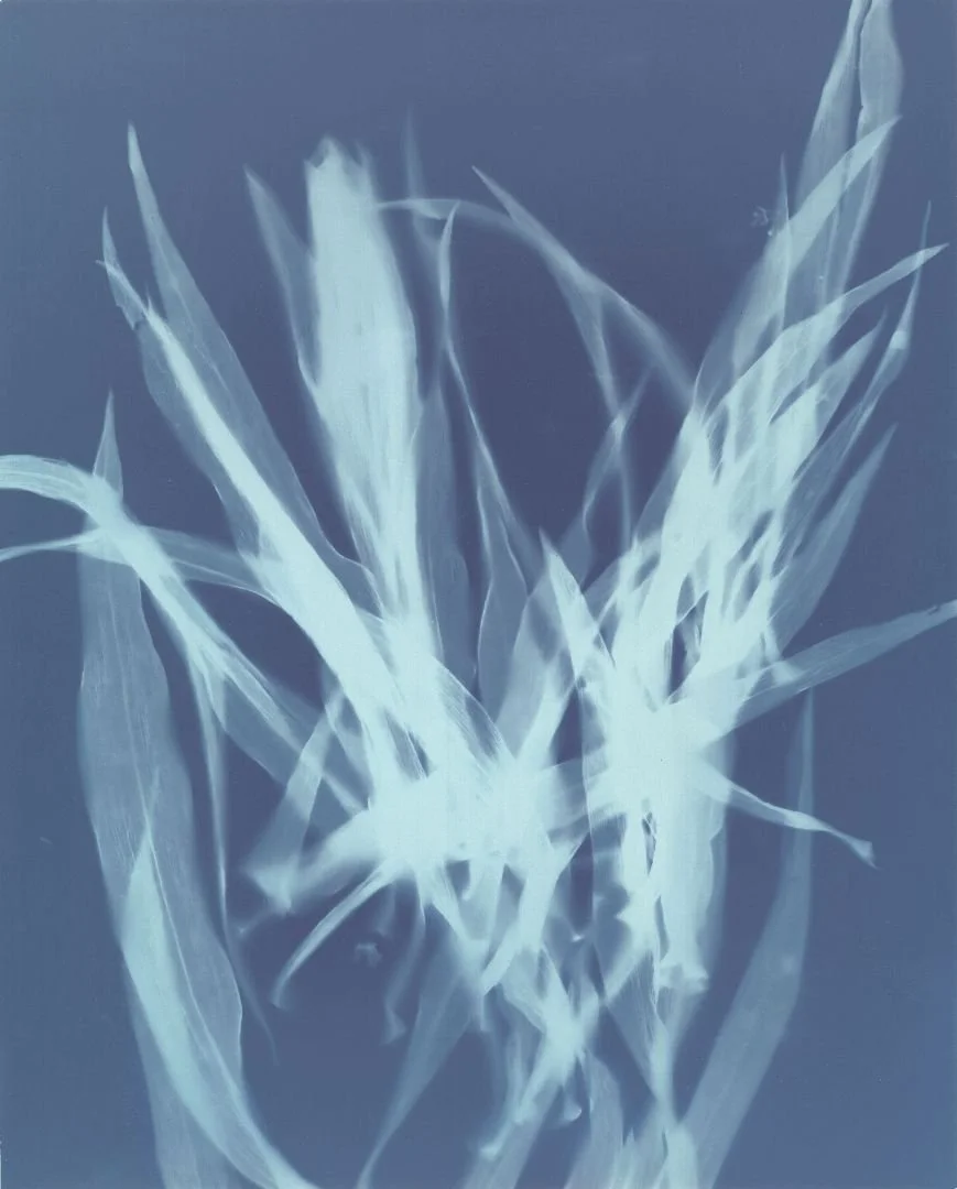 X-ray image of a human pelvis and hips.